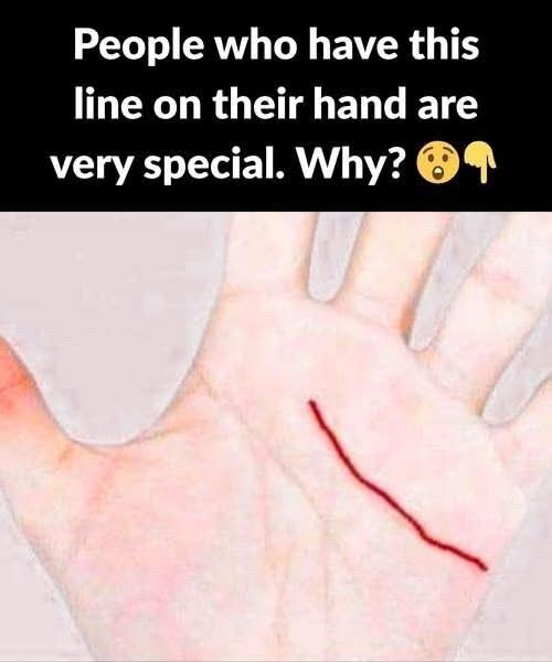 People who have this line on their hand are very special…. Read full ...